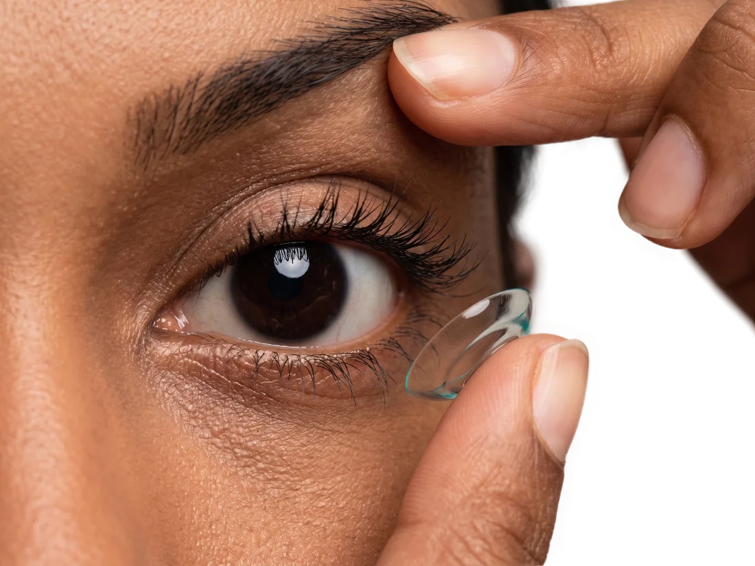 Close-up of a person inserting an Ortho-K gas-permeable contact lens onto the eye for non-surgical vision correction
